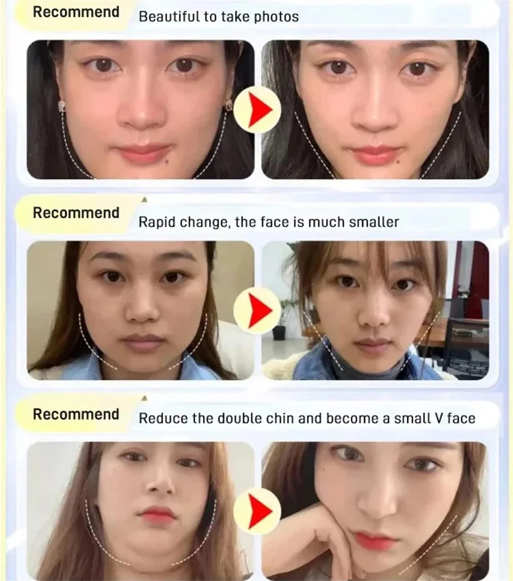 V-Line Face Sculpting Sleep Mask for Jawline Lift